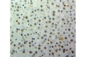 IHC-P analysis of Liver tissue, with DAB staining. (HNF1B 抗体  (AA 159-300))