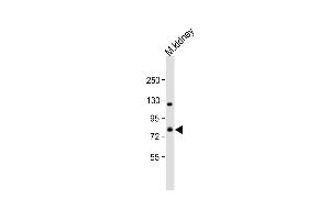 Anti-AD Antibody (C-term) at 1:2000 dilution + mouse kidney lysate Lysates/proteins at 20 μg per lane.