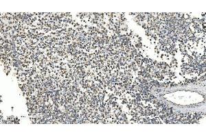 IHC analysis of NOX2/gp91phox/CYBB using anti-NOX2/gp91phox/CYBB antibody (ABIN7599875). (CYBB 抗体  (AA 124-559))
