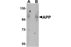Western blot analysis of APP in mouse brain tissue lysate with AP30072PU-N APP antibody at (A) 1 and (B) 2 μg/ml. (APP 抗体  (N-Term))