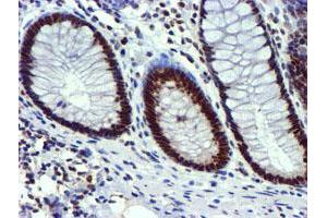 Image no. 3 for anti-Ubiquitin Specific Peptidase 7 (Herpes Virus-Associated) (USP7) antibody (ABIN1498592) (USP7 抗体)