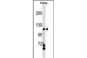 FC Antibody (C-term) (ABIN1537556 and ABIN2849534) western blot analysis in Hela cell line lysates (35 μg/lane). (FAM65C 抗体  (C-Term))