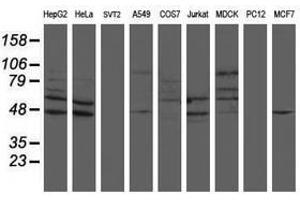 Image no. 1 for anti-SUMO1/sentrin/SMT3 Specific Peptidase 2 (SENP2) (AA 139-523) antibody (ABIN1490927) (SENP2 抗体  (AA 139-523))