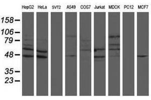 Image no. 1 for anti-SUMO1/sentrin/SMT3 Specific Peptidase 2 (SENP2) (AA 139-523) antibody (ABIN1490927) (SENP2 抗体  (AA 139-523))