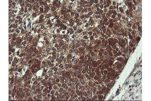 Image no. 3 for anti-Prefoldin Subunit 3 (PFDN3) antibody (ABIN1501704)