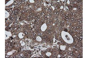Image no. 5 for anti-RIO Kinase 2 (RIOK2) (AA 277-552) antibody (ABIN1491305)