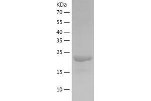 Western Blotting (WB) image for Chloride Channel, Nucleotide-Sensitive, 1A (CLNS1A) (AA 1-237) protein (His tag) (ABIN7122350) (CLNS1A Protein (AA 1-237) (His tag))