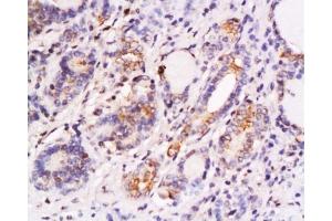 Immunohistochemistry (Paraffin-embedded Sections) (IHC (p)) image for anti-S-Phase Kinase-Associated Protein 2 (SKP2) (AA 351-424) antibody (ABIN737601)