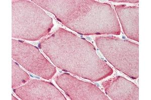 Anti-CA3 / Carbonic Anhydrase III antibody IHC staining of human skeletal muscle. (CA3 抗体  (AA 17-46))