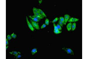 Immunofluorescent analysis of HepG2 cells cells using ABIN7174258 at dilution of 1:100 and Alexa Fluor 488-congugated AffiniPure Goat Anti-Rabbit IgG(H+L) (USP14 抗体  (C-Term))