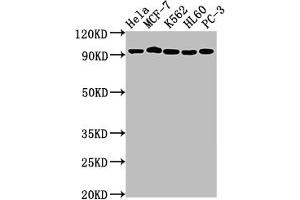 Western Blot Positive WB detected in: Hela whole cell lysate, MCF-7 whole cell lysate, K562 whole cell lysate, HL60 whole cell lysate, PC-3 whole cell lysate All lanes: TOP1 antibody at 1:2000 Secondary Goat polyclonal to rabbit IgG at 1/50000 dilution Predicted band size: 91 kDa Observed band size: 91 kDa (Recombinant Topoisomerase I 抗体)