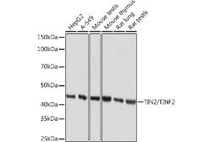 Western blot analysis of extracts of various cell lines, using TIN2/TINF2 Rabbit mAb (ABIN7270771) at 1:1000 dilution. (TINF2 抗体)