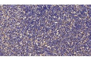 Detection of Surv in Human Lymph node Tissue using Monoclonal Antibody to Survivin (Surv)