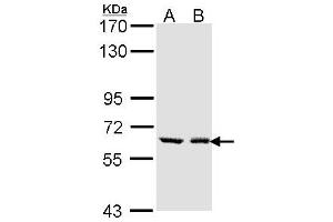 Image no. 1 for anti-UDP Glucuronosyltransferase 1 Family, Polypeptide A6 (UGT1A6) (AA 8-197) antibody (ABIN467620) (UGT1A6 抗体  (AA 8-197))
