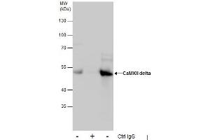 IP Image Immunoprecipitation of CaMKII delta protein from HepG2 whole cell extracts using 5 μg of CaMKII delta antibody, Western blot analysis was performed using CaMKII delta antibody, EasyBlot anti-Rabbit IgG  was used as a secondary reagent. (CAMK2D 抗体)