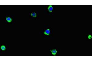 Immunofluorescent analysis of A375 cells using ABIN7157921 at dilution of 1:100 and Alexa Fluor 488-congugated AffiniPure Goat Anti-Rabbit IgG(H+L)