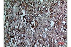 Immunohistochemistry (IHC) analysis of paraffin-embedded Human Kidney, antibody was diluted at 1:100. (BNIP3 抗体  (Internal Region))