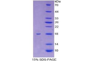 SDS-PAGE analysis of Human KIF5A Protein. (KIF5A 蛋白)