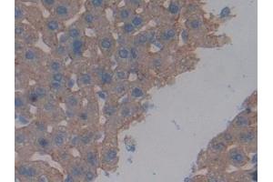 Detection of ASGR1 in Mouse Liver Tissue using Polyclonal Antibody to Asialoglycoprotein Receptor 1 (ASGR1) (Asialoglycoprotein Receptor 1 抗体  (AA 80-281))