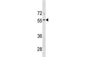 BMP8A antibody western blot analysis in CEM lysate (BMP8A 抗体  (AA 271-298))
