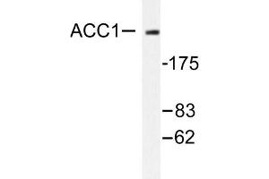 Image no. 1 for anti-Acetyl-CoA Carboxylase alpha (ACACA) antibody (ABIN271865) (Acetyl-CoA Carboxylase alpha 抗体)