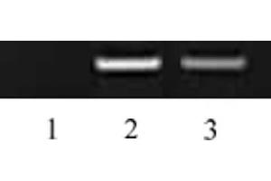 Histone H3 dimethyl Lys27 antibody tested by ChIP. (Histone 3 抗体  (H3K27me2))