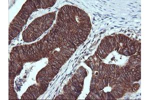 Immunohistochemistry (IHC) image for anti-Acetyl-CoA Acyltransferase 2 (ACAA2) antibody (ABIN1495727) (ACAA2 抗体)