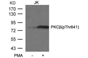 Western blot analysis of extracts from JK cells untreated or treated with PMA using PKCβ (phospho-Thr641) antibody. (PKC beta 抗体  (pThr641))