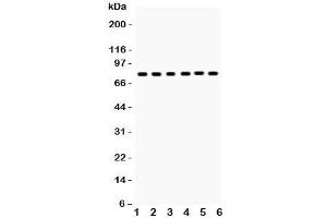 Western blot testing of tPA antibody and Lane 1:  mouse lung;  2: (m) testis; and human samples  3: U87;  4: A431;  5: A375;  6: A549 lysate (PLAT 抗体  (AA 366-562))