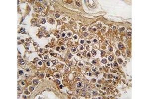 IHC analysis of FFPE human testis tissue stained with ALK antibody (ALK 抗体  (AA 636-666))