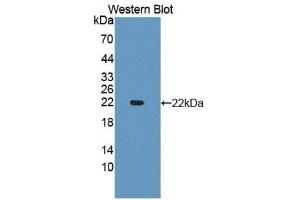 Western Blotting (WB) image for anti-Slit Homolog 3 (SLIT3) antibody (Biotin) (ABIN1176109) (SLIT3 抗体  (Biotin))