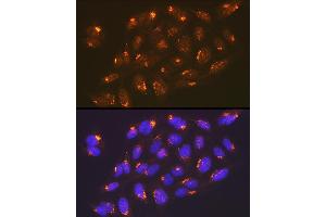 Immunofluorescence analysis of U-2 OS cells using TGN46/TGOLN2 Rabbit mAb (ABIN7270875) at dilution of 1:100 (40x lens). (TGOLN2 抗体)