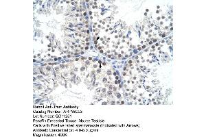 Mouse testicle (TFAM 抗体  (C-Term))