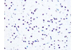 Immunohistochemistry of paraffin-embedded rat brain using NUM Rabbit mAb (ABIN7269002) at dilution of 1:100 (40x lens). (NUMA1 抗体)