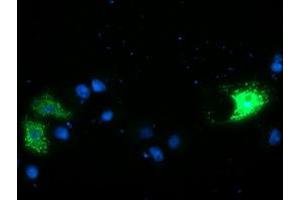 Anti-CAMLG mouse monoclonal antibody (ABIN2455605) immunofluorescent staining of COS7 cells transiently transfected by pCMV6-ENTRY CAMLG (RC218292). (CAMLG 抗体)