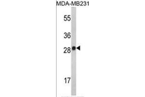 Western blot analysis of AP17501PU-N IL2 Antibody (Center) in MDA-MB231 cell line lysates (35 µg/lane). (IL-2 抗体  (AA 57-86))