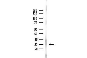 anti-RAB38, Member RAS Oncogene Family (RAB38) (Internal Region) antibody