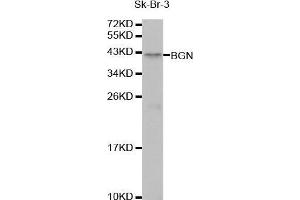 Western Blotting (WB) image for anti-Biglycan (BGN) (AA 20-230) antibody (ABIN1678858) (Biglycan 抗体  (AA 20-230))