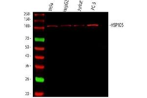 Western blot analysis of Hsp105 using anti-Hsp105 antibody (ABIN5693036). (HSPH1 抗体  (AA 653-858))