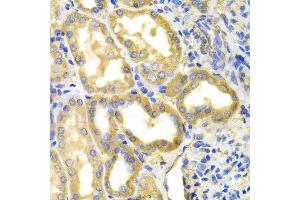 Immunohistochemistry of paraffin-embedded human kidney using DPYD antibody at dilution of 1:100 (x400 lens). (DPYD 抗体)