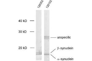 dilution: 1 : 1000, sample: crude synaptosomal fraction of rat brain (P2) (Alpha, beta Synuclein (AA 2-25), (N-Term) 抗体)