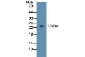 Detection of SDF2 in Human HepG2 Cells using Polyclonal Antibody to Stromal Cell Derived Factor 2 (SDF2) (SDF2 抗体  (AA 19-211))
