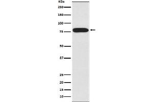 Western blot analysis of IRAK expression in HeLa cell lysate.