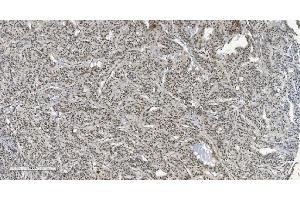 IHC analysis of HP1 alpha/CBX5 using anti-HP1 alpha/CBX5 antibody (ABIN7599057).