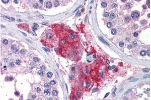 Immunohistochemistry (IHC) image for anti-Acylphosphatase 1, Erythrocyte (Common) Type (Acyp1) (Internal Region) antibody (ABIN190881)