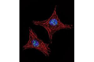 Immunofluorescence (IF) image for anti-Ubiquitously Transcribed Tetratricopeptide Repeat Gene, Y-Linked (UTY) (AA 1247-1276), (C-Term) antibody (ABIN653016)