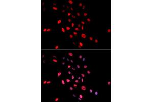 Immunofluorescence analysis of MCF7 cell using Phospho-c-Jun-S63 antibody. (C-JUN 抗体  (pSer63))