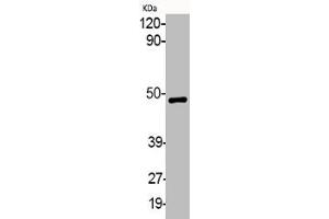 Western Blotting (WB) image for anti-Mitogen-Activated Protein Kinase Kinase 1 (MAP2K1) (pSer218), (pSer222) antibody (ABIN7181957)