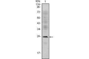 Western blot analysis using CD3E mouse mAb against Jurkat (1) cell lysate. (CD3 epsilon 抗体)