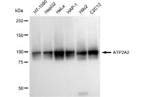 Western blotting analysis using ATP2A2 antibody (ABIN7797694).